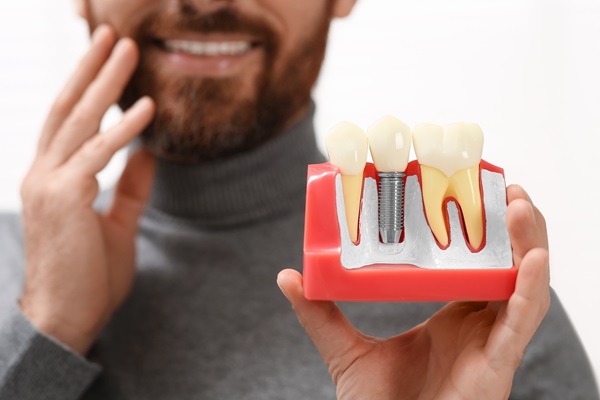 Five Questions To Ask A General Dentist About A Dental Implant Restoration